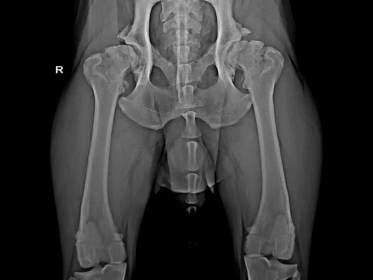 a1259-01-osteoartroza-a-rehabilitace